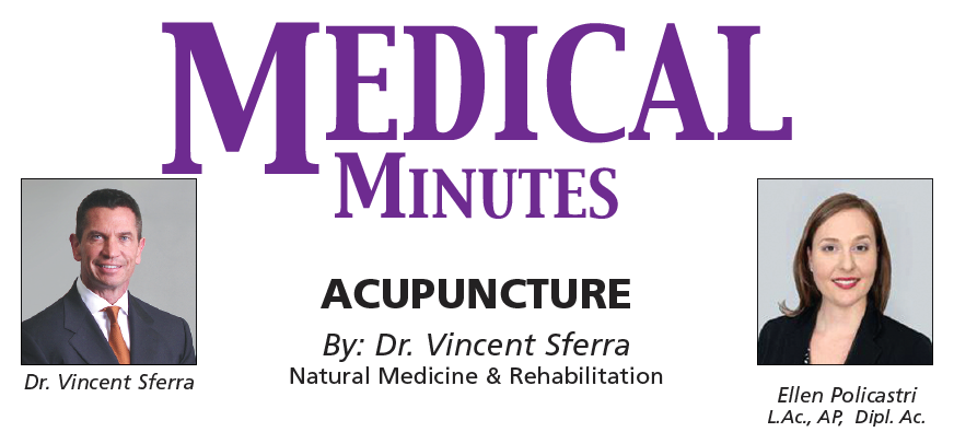 MEDICAL MINUTES: Acupuncture  By: Dr. Vincent Sferra